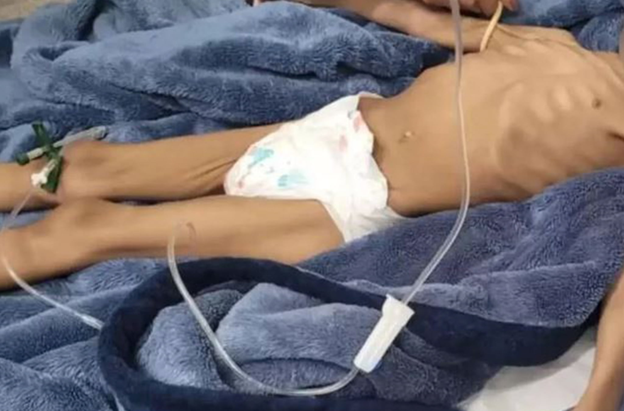 Menina Desnutrida de 3 Anos é Resgatada e Pai é Preso