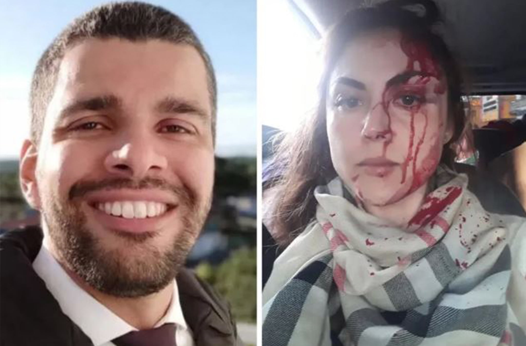 Procurador Esquizofrênico Que Espancou a Chefe é Absolvido Pela Justiça