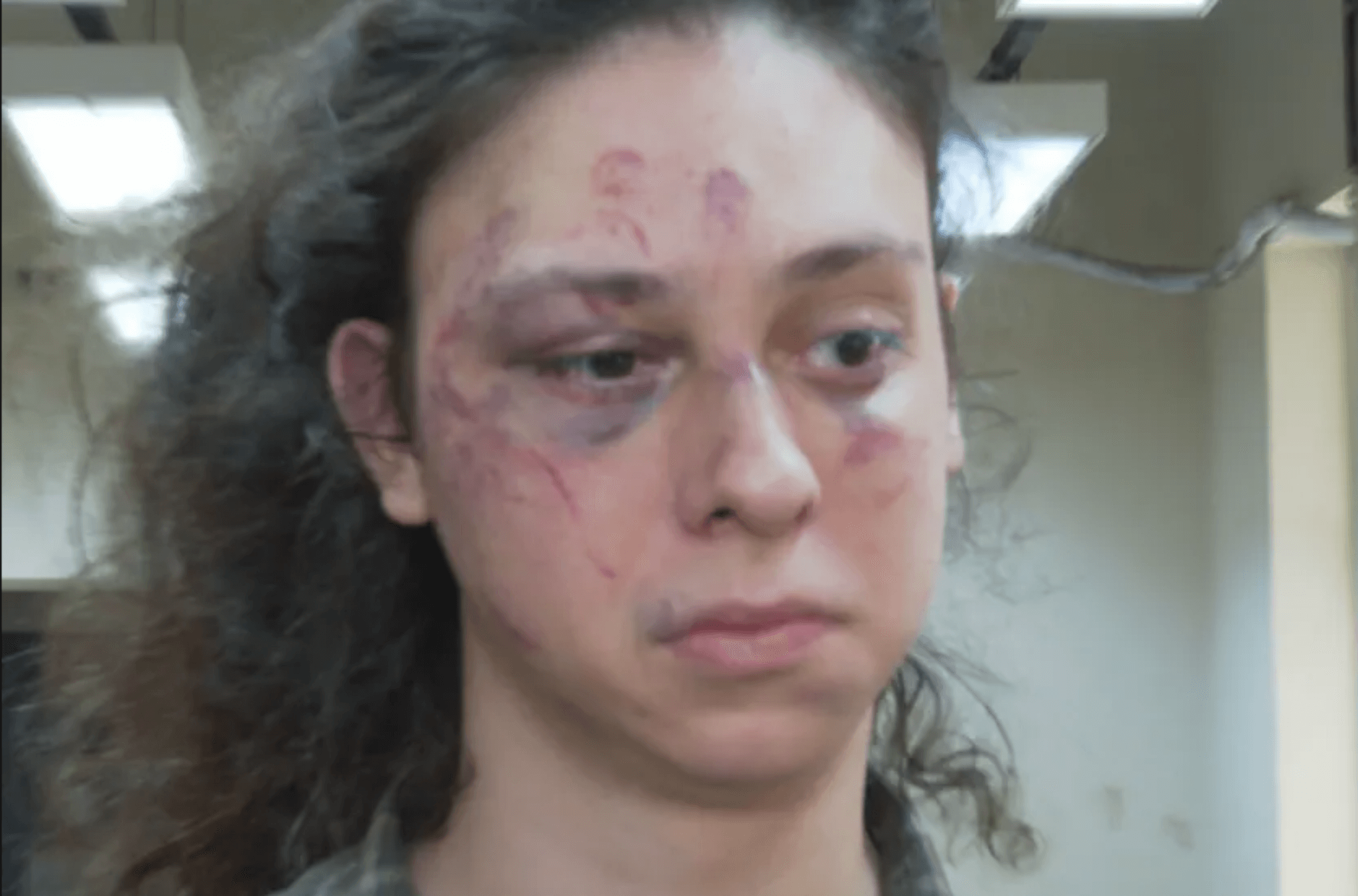 Ator sofre ataque brutal de homofobia