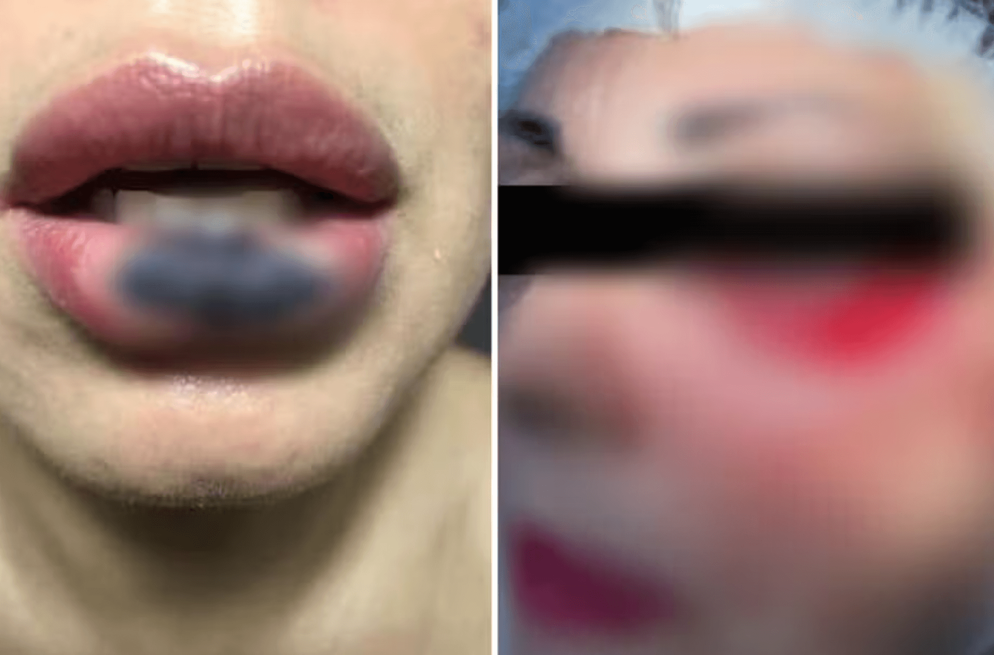 É presa dentista suspeita de deformar o rosto de diversas pacientes em Goiânia