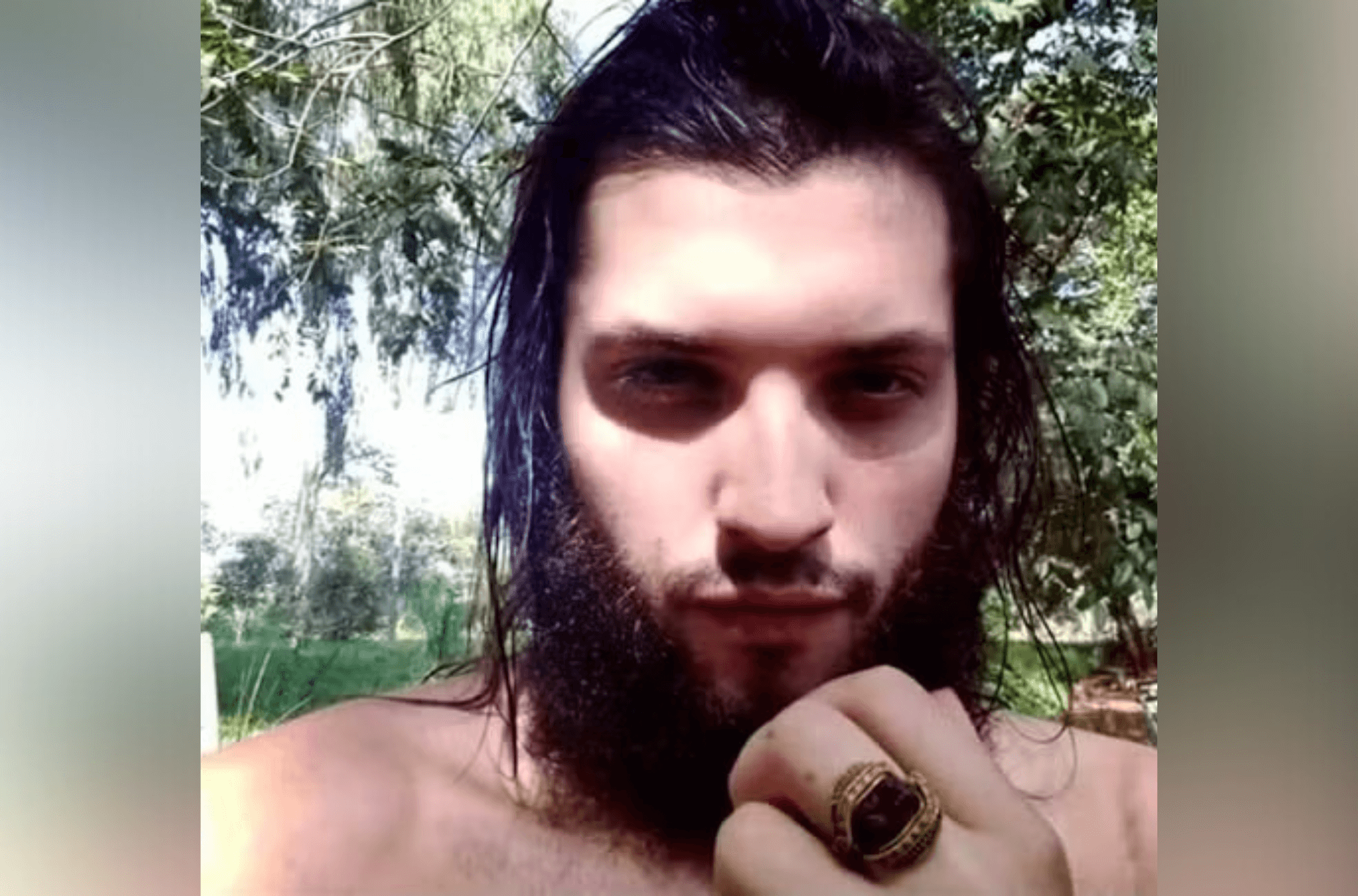 Imagem ilustra suspeito morto