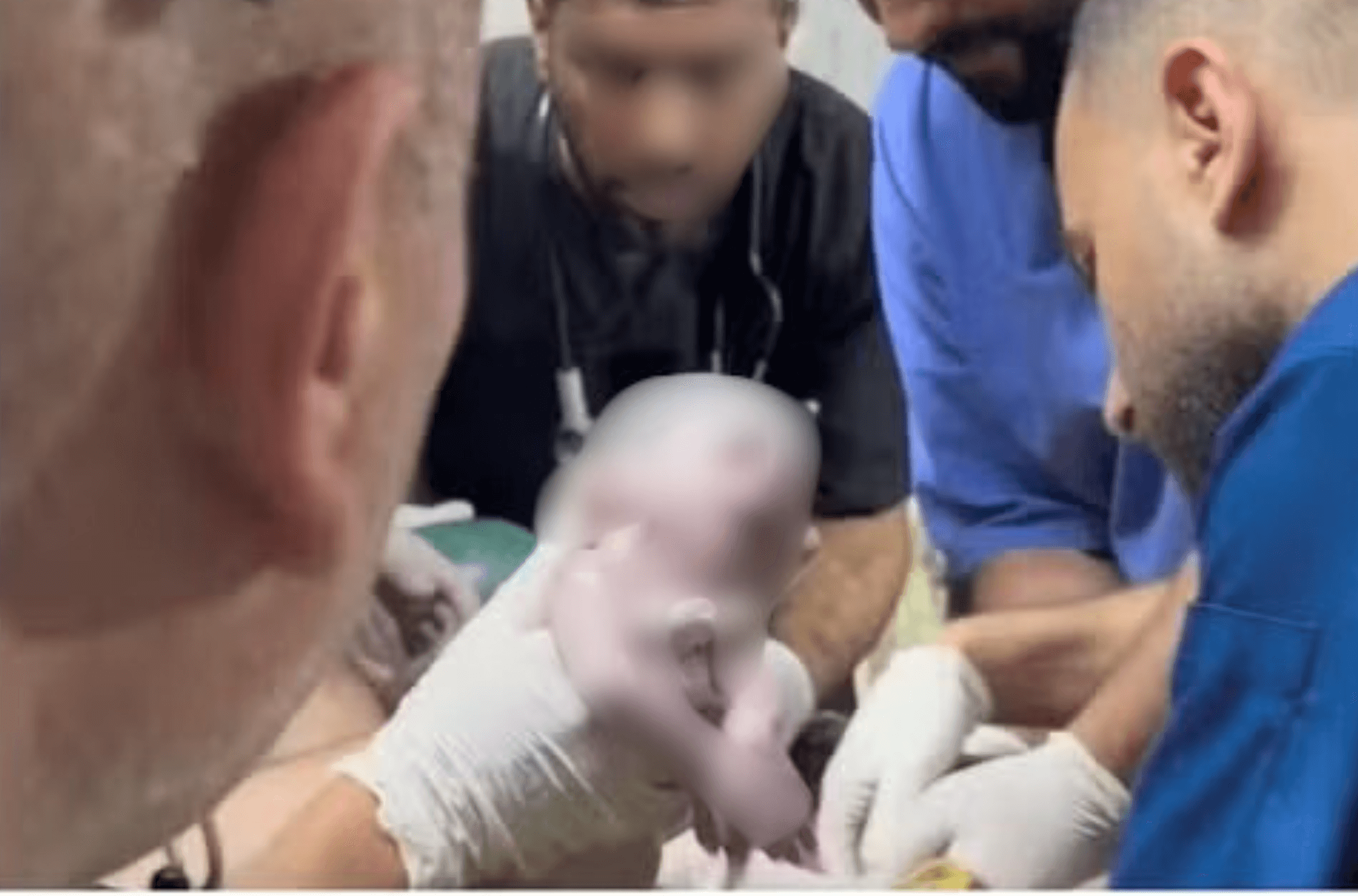 Imagem ilustra bebê sendo salva em cesariana de emergência