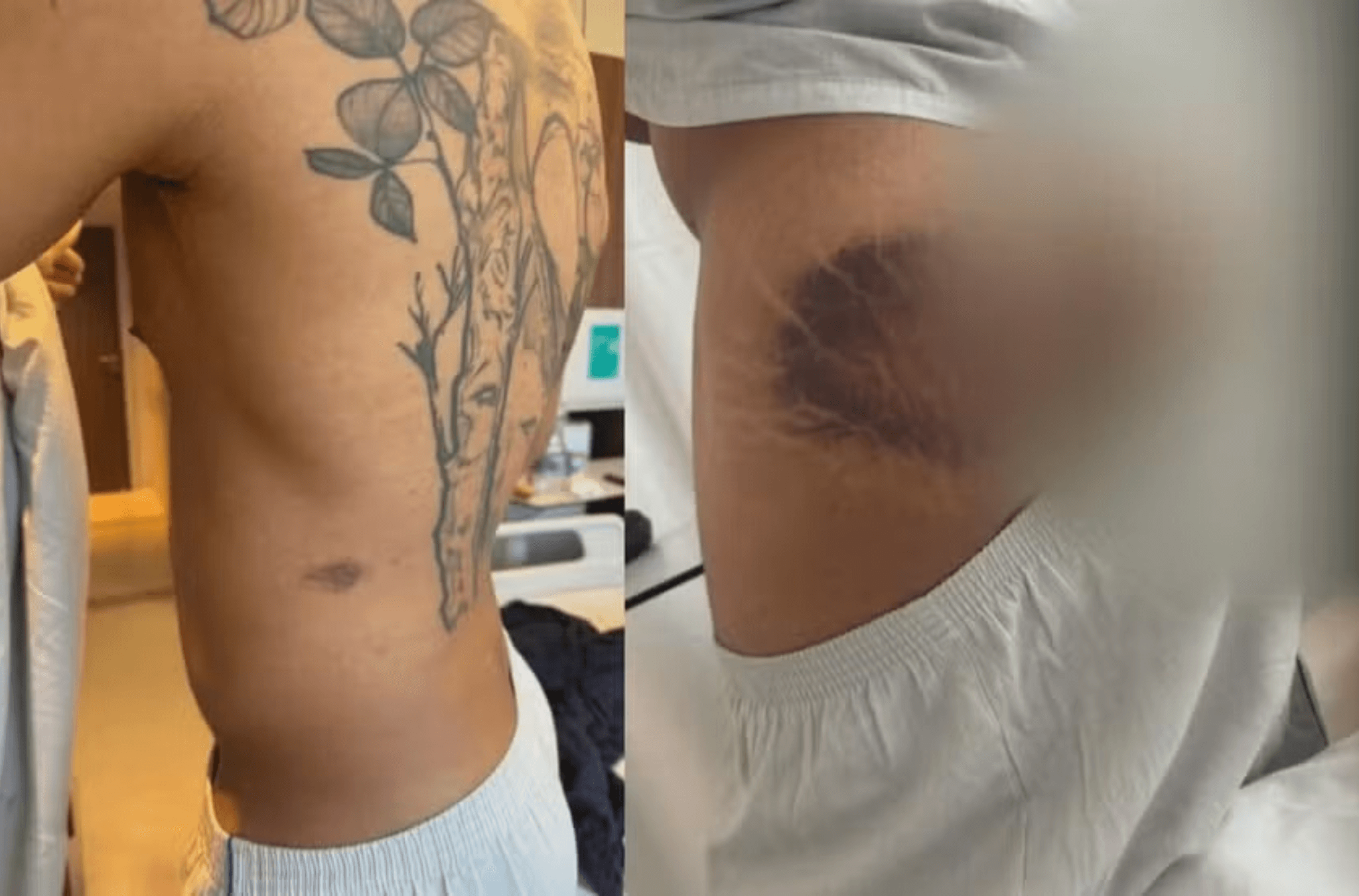 imagem ilustra ferimentos de vítima