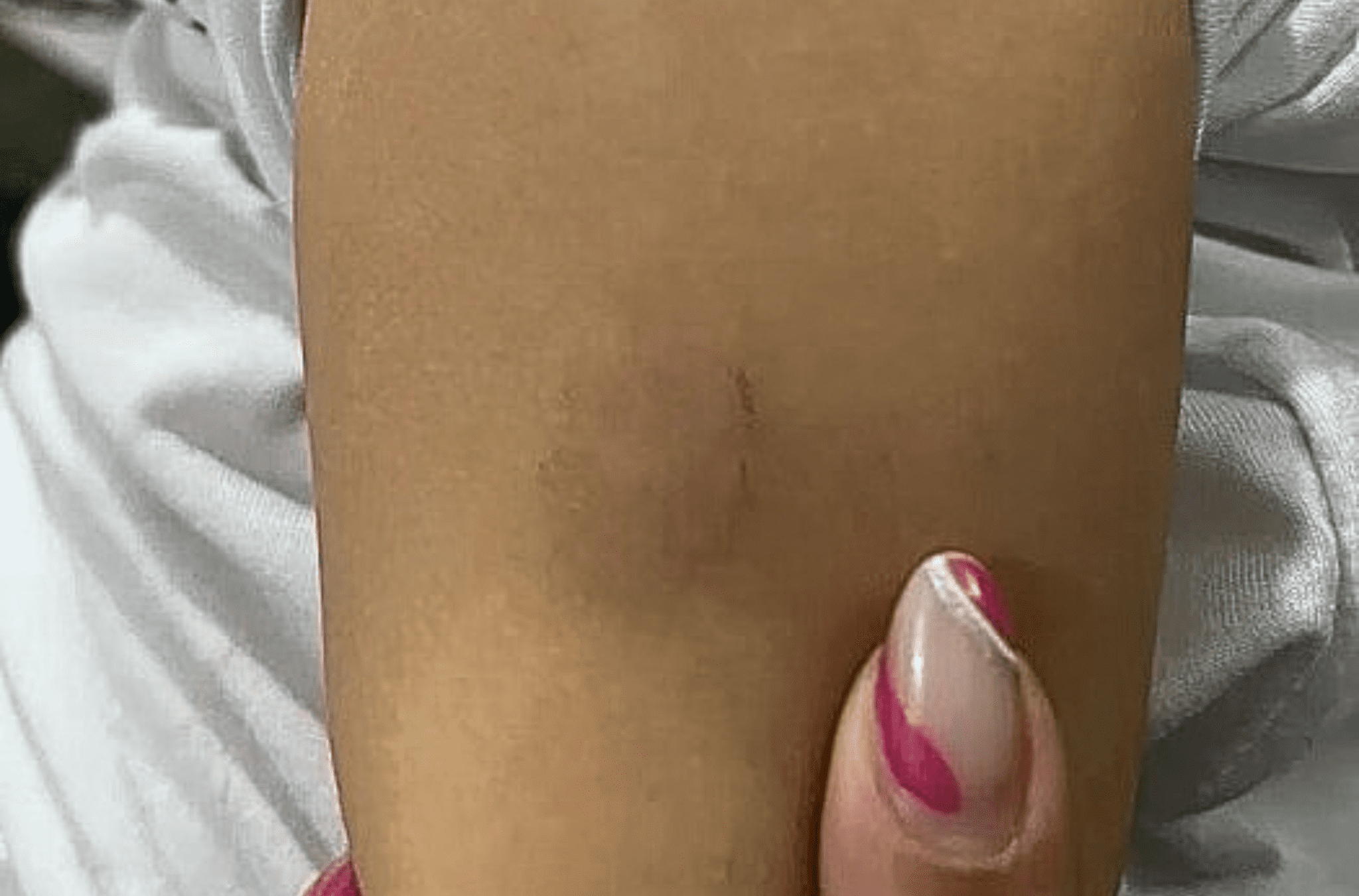 Imagem ilustra a vítima