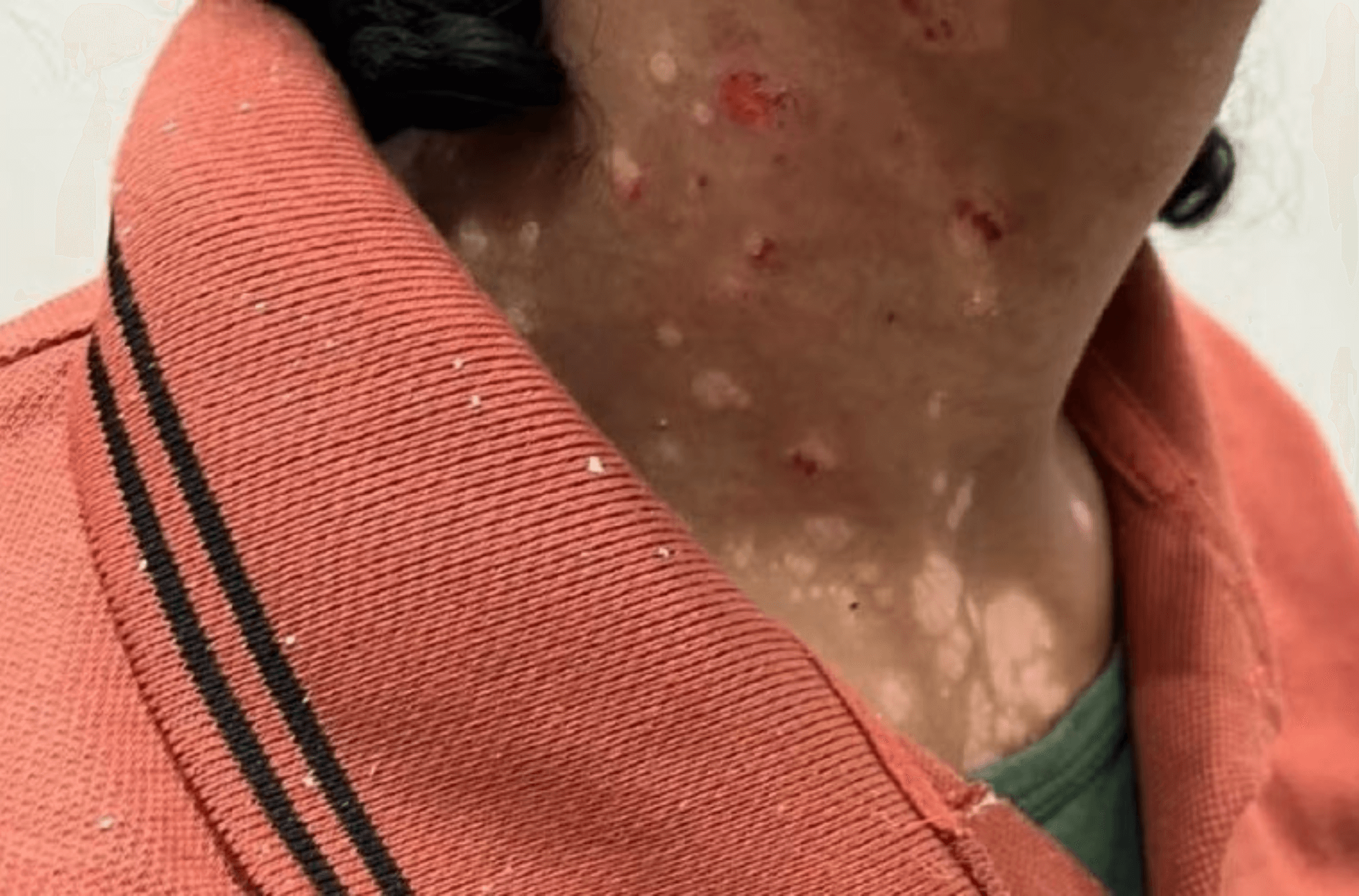 Imagem ilustra ferimentos dos abusos