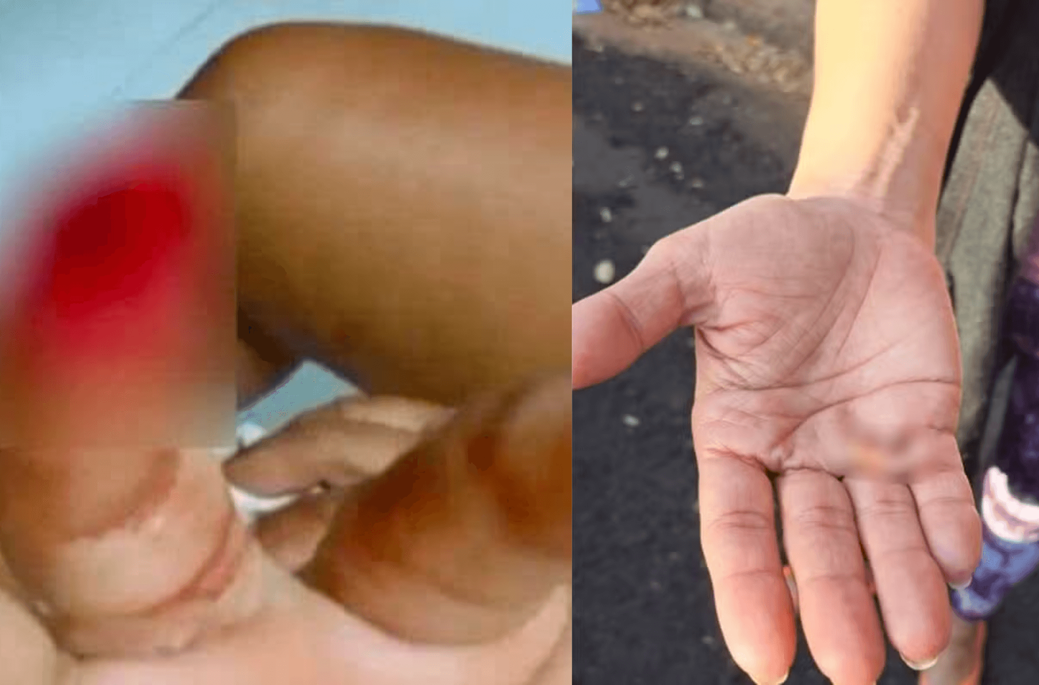 Dois homens são presos por mutilar mulheres